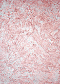 Textura 10